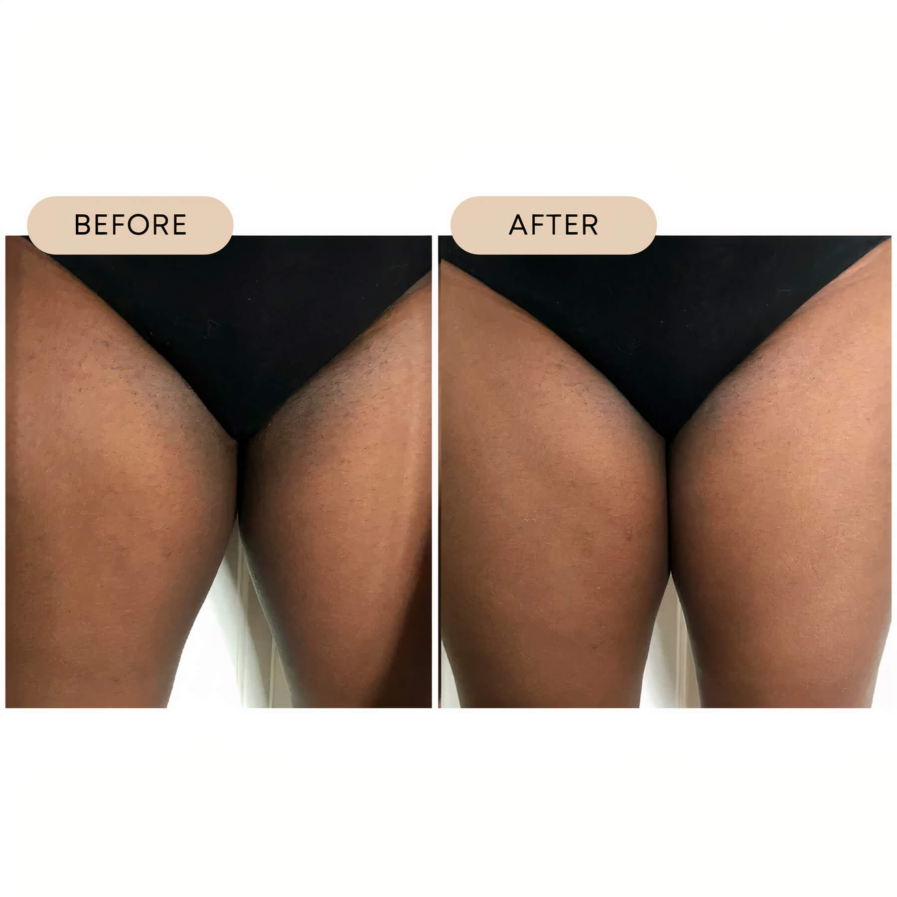 BushBalm | Bermuda Dark Spot Oil