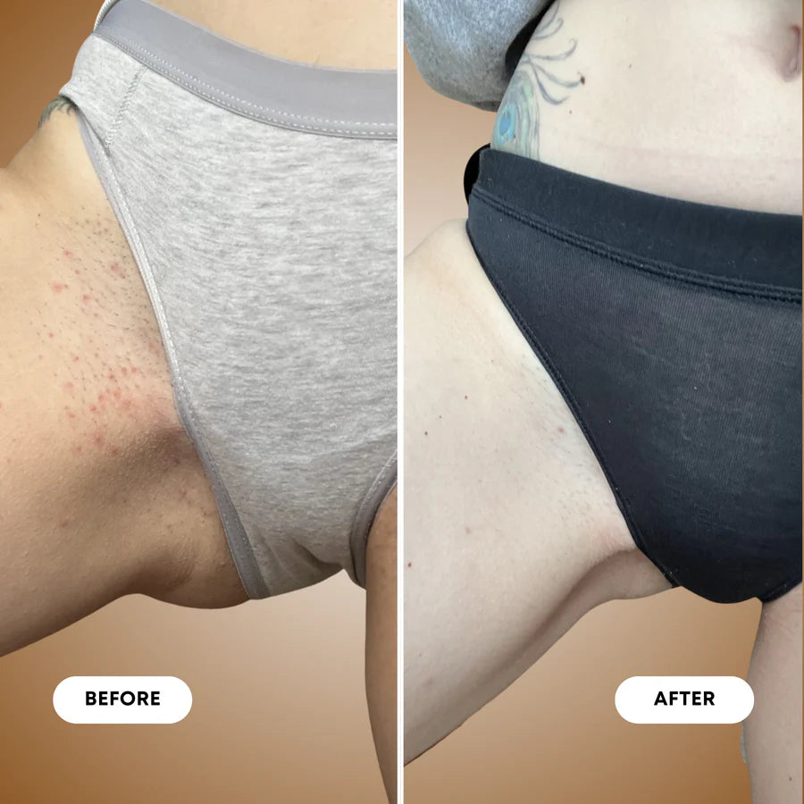 BushBalm | Vanilla Coconut Ingrown Hair Exfoliating Scrub