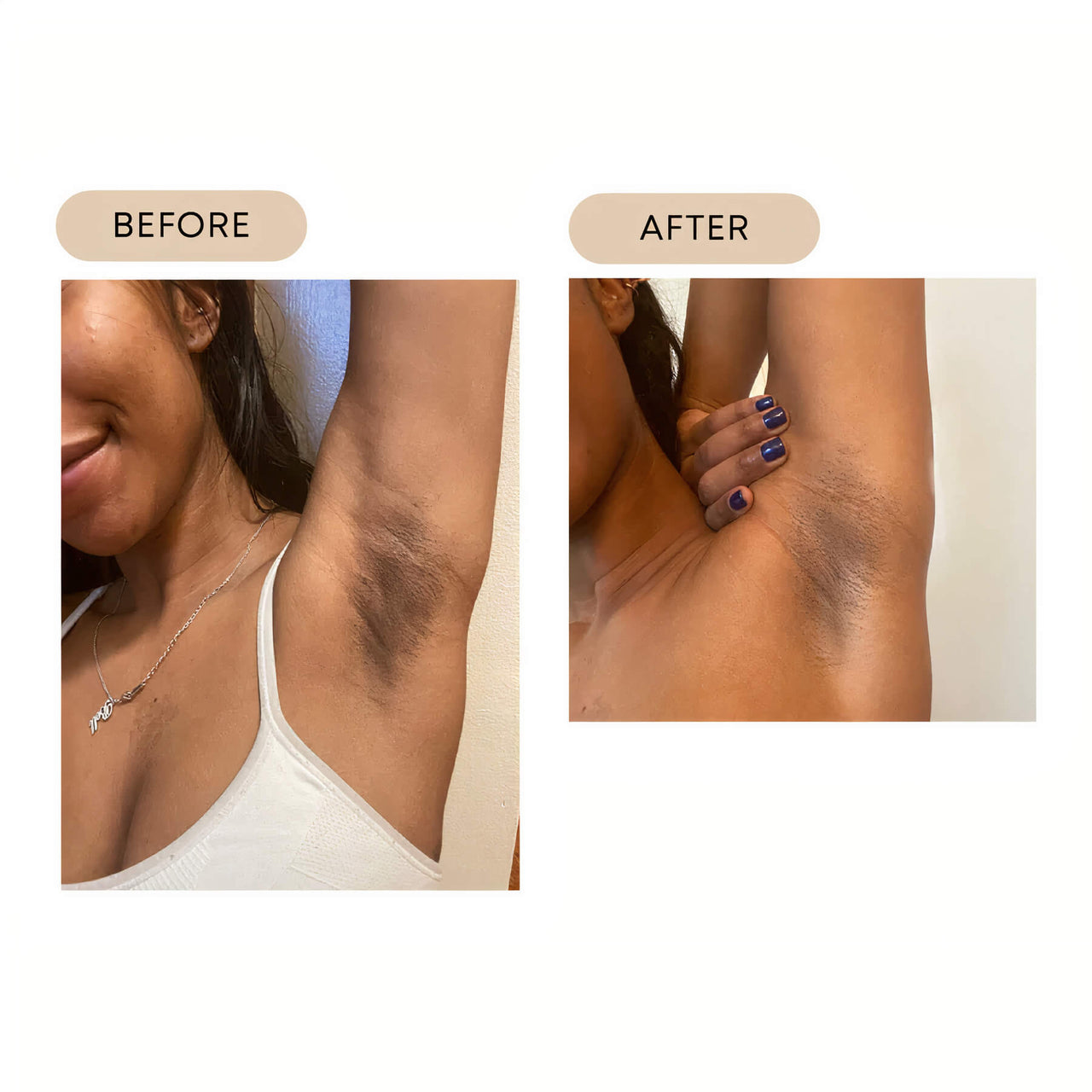 BushBalm | Bermuda Dark Spot Oil