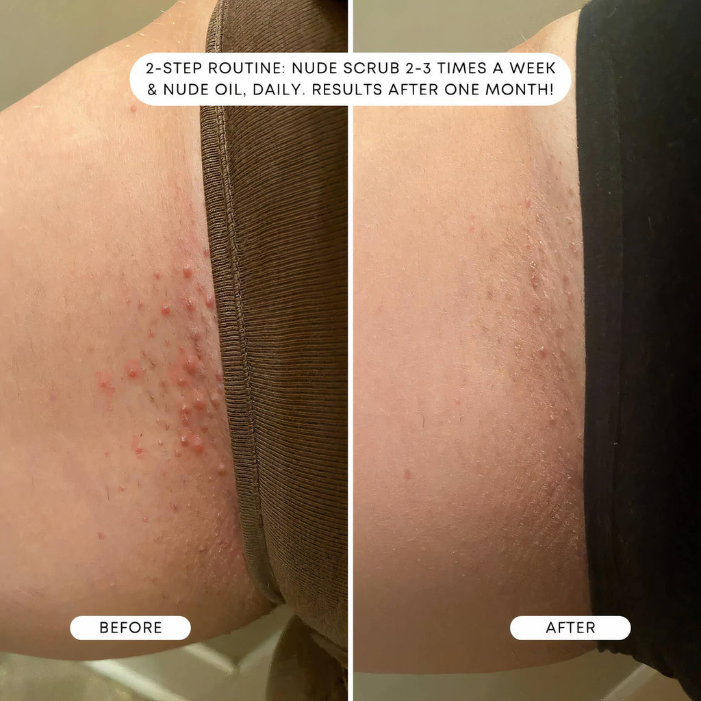 BushBalm | Nude Ingrown Hair Oil