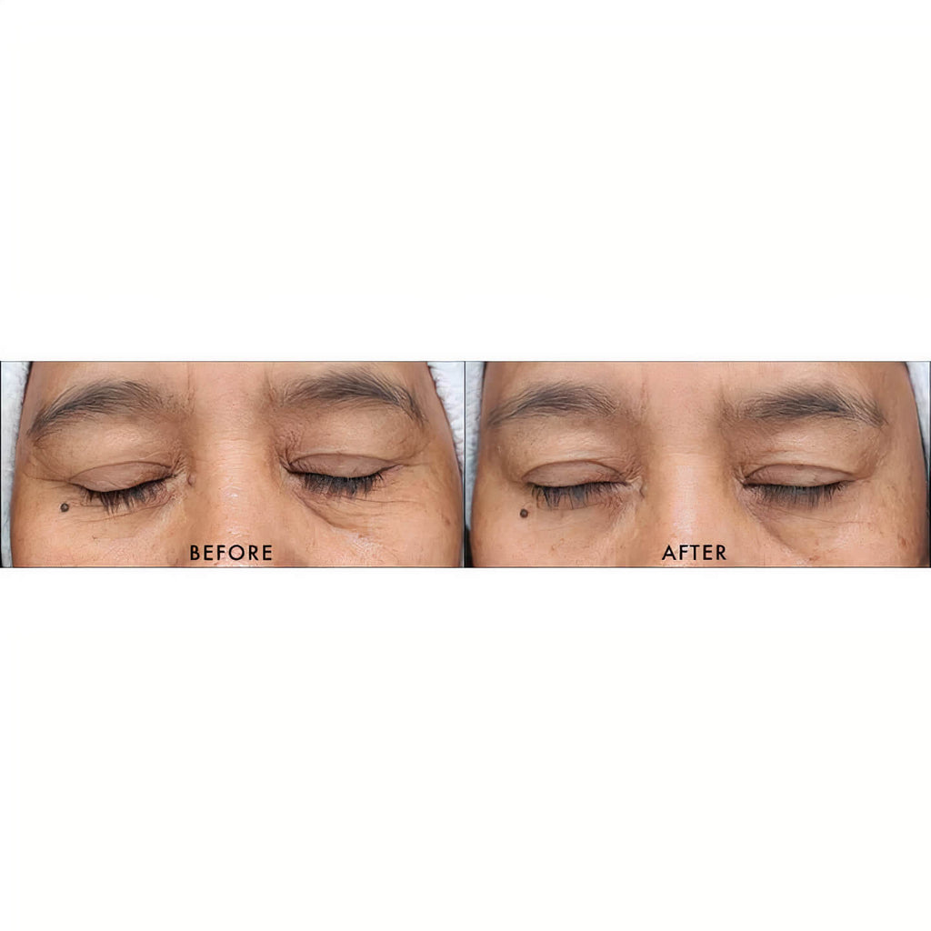 iS Clinical | Youth Serum