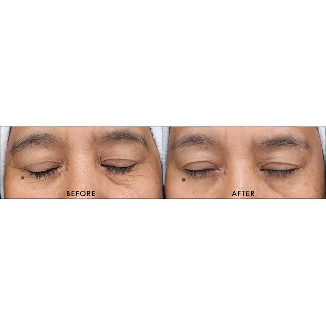 iS Clinical | Youth Serum